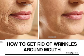 Ways To Get Rid Of Wrinkles Around Mouth Naturally