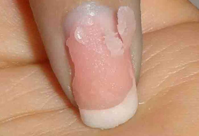 How to Remove Acrylic Nails With Acetone