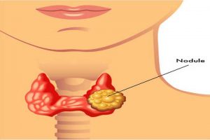 Thyroid Naturally