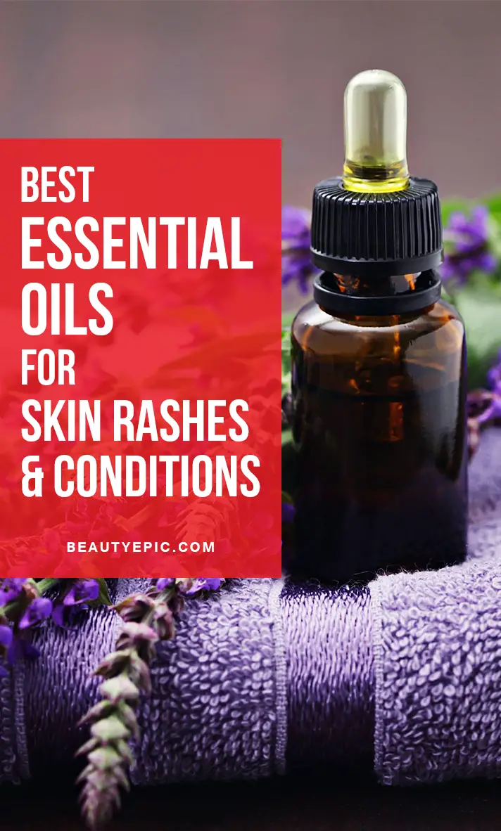 16 Best Essential Oils for Skin Rashes & Conditions