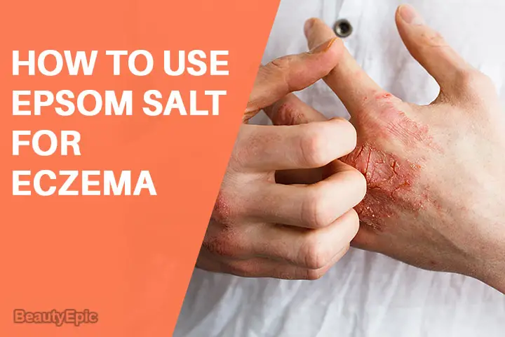 How To Use Epsom Salt For Eczema 