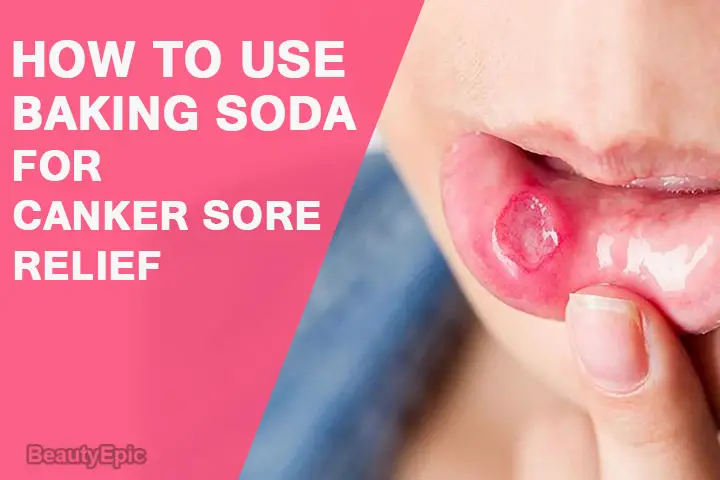 How Can Baking Soda Help Relieve Canker Sores 