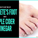 How to Treat Sinus Infection Quickly with Apple Cider Vinegar