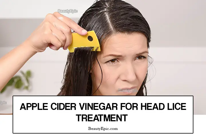 How To Treat Head Lice With Apple Cider Vinegar 