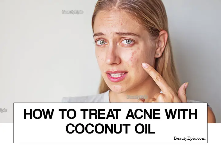 How Do You Use Coconut Oil For Acne 