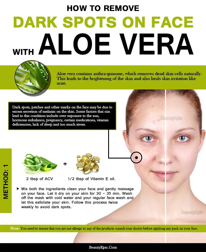 How To Use Aloe Vera To Remove Dark Spots On Face