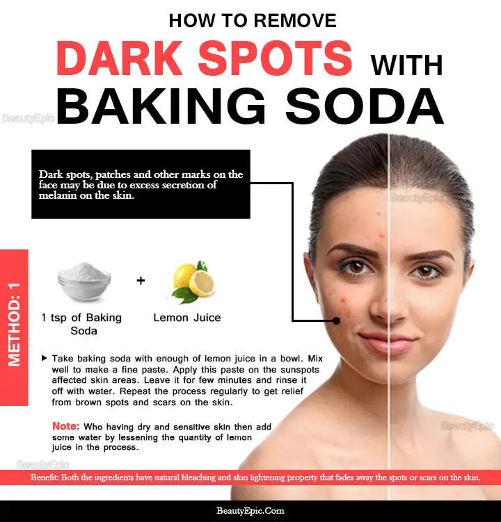 6 Easy Ways To Remove Dark Spots With Baking Soda Naturally