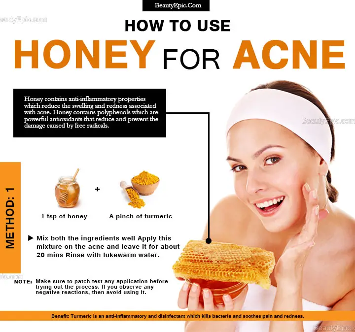 7 Effective Ways To Get Rid Of Acne With Honey