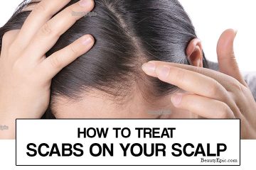 How To Get Rid Of Scabs On Scalp - What It Is, Causes And How To Treat