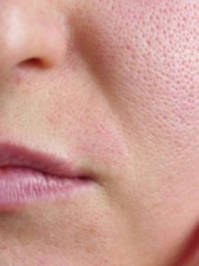 cropped skin pores